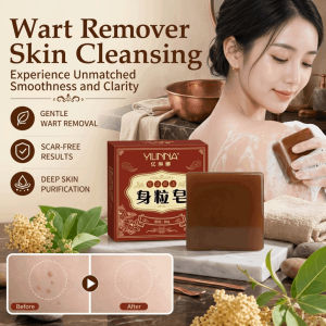 Yunnan Herbal Wart Removal Soap Skin Cleansing Handmade Soap Oil Control Moisturizing Plant Based Face Body Soap 净肤身粒皂