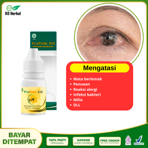 Obat Mata Berlemak Mata Pterigium Obat Mata Berbayang Selaput Putih Di Mata Penghilang Propolis SM