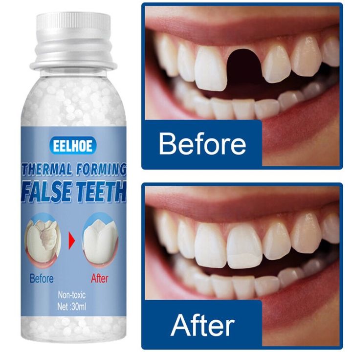 10/20/30G Teeth Solid Glue Denture Filling Solid Gel Denture Adhesive Glue Temporary Tooth Repair Kit Teeth Solid Glue Tooth Replacement  Tools Oral Care