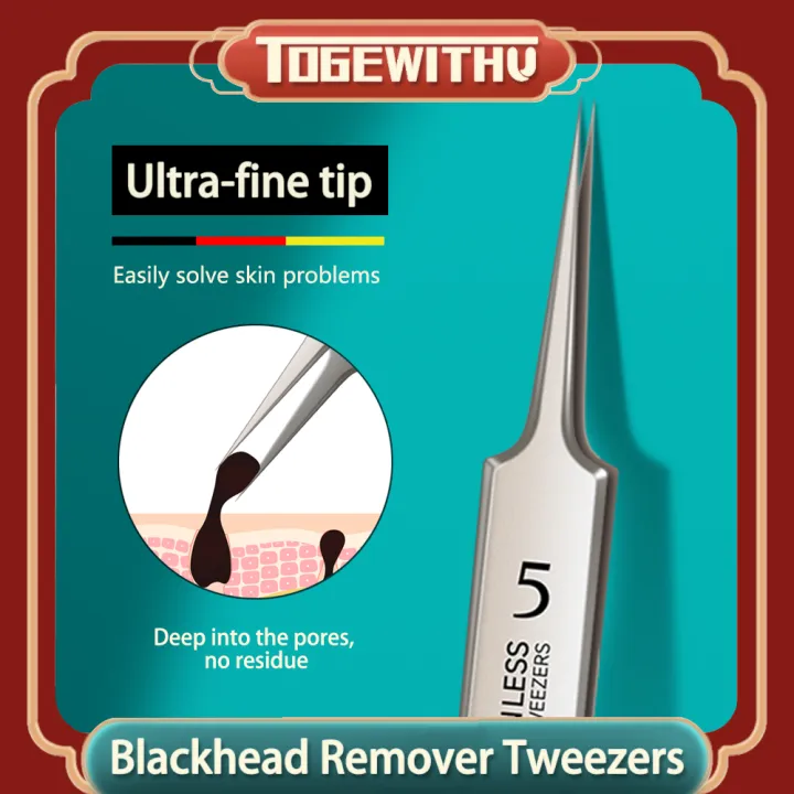 Blackhead%20Remover%20Tweezers,%20Blackhead%20Remover%20Comedone%20Extractor%20Stainless%20Steel%20Precision%20Pimple%20Popper%20Tool%20for%20Whitehead%20Acne%20Blemishes%20-%20Image%202