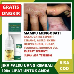 Obat Cenang Bernanah Cenang Di Tangan Cenang Di Telapak Tangan Kaki Cenang Di Kaki Obat Gatal Bernanah Kulit Nanahan Luka Borok Bernanah Cenang Berair Salep Penghilang Cenangan Salep Buat Koreng Benjolan Nanah Di Jari Jari Tangan Propolis SM