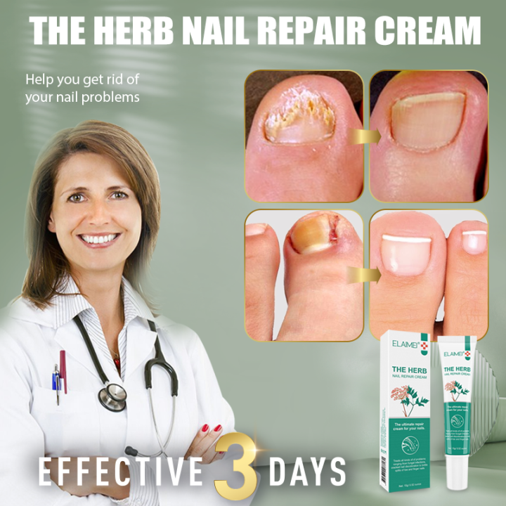 Betadine™ Emtrix™ Fungal Nail Solution - Peanut Gallery 247