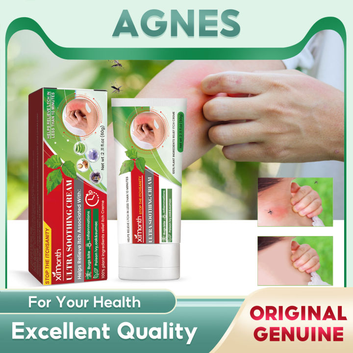 Ximonth Relief Mosquito Bites Insect Anti-Itch Cream Itching Prickly ...