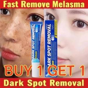 【BUY 1 GET 1】Freckle Cream for Face  Melasma Dark Spots Wrinkles Blemishes freckle cream 20g
