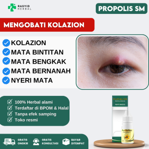 Obat Oles Kalazion Obat Mata Kalazion Pada Anak Dan Dewasa Obat Bintitan Obat Mata Bintitan Obat Mata Bengkak DENGAN PROPOLIS SM BRAZAIL 100% ASLI ORIGINAL BERLEGALITAS BPOM DAN HALAL MUI