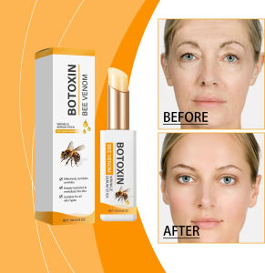 Anti wrinkle eye ointment is used for dark circles eye bags and puffiness