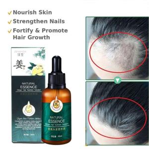 Castor Oil Hair Treatment & Minoxidil Hair Grower: A Comprehensive Guide