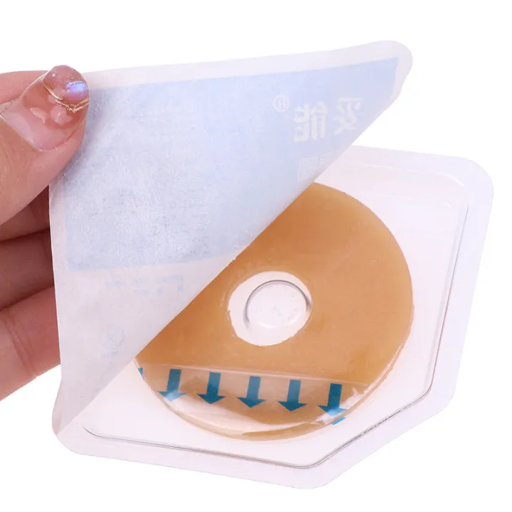 1Pc%20ostomy%20paste%20baseplates%20stoma%20%E0%B8%94%E0%B8%B9%E0%B9%81%E0%B8%A5%E0%B8%A7%E0%B8%87%E0%B9%81%E0%B8%AB%E0%B8%A7%E0%B8%99%E0%B8%9B%E0%B9%89%E0%B8%AD%E0%B8%87%E0%B8%81%E0%B8%B1%E0%B8%99%E0%B8%81%E0%B8%B2%E0%B8%A3%E0%B8%A3%E0%B8%B1%E0%B9%88%E0%B8%A7%202/3/4mm%20-%20Image%207