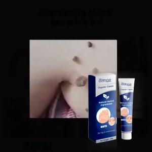 EELHOE  Wart Cream   Cleans the body reduces skin moles black moles corns repairs and smoothes the skin wart removal cream