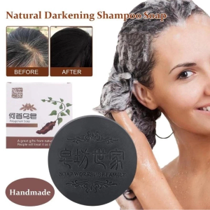 KORMESIC Minoxidil 5% Hair Grower with Biotin Shampoo And Conditioner 300ml for Hair Loss Treatment