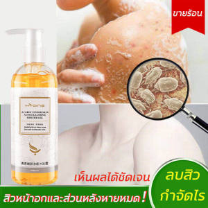 Hyqing 260ml gentle shower cream non-irritating remove mite clear skin without acne (liquid soap shower gel bath cream) body wash and moisturizing