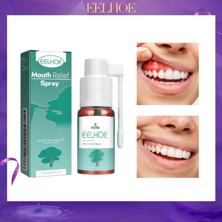 Eelhoe Oral Relief Spray To Relieve Periodontal Gingival Pain, Mouth ...