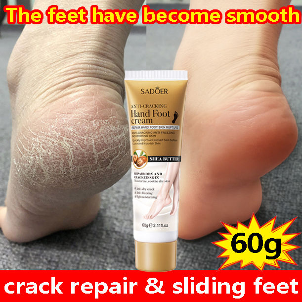 Dry Skin Best Products For Cracked Feet Quick Fix】hand Foot Cream