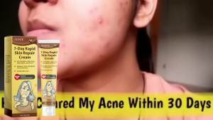 🛒 Murah Meriah!OUHOE Skin Neck Cream Facial Moisturizing Hydrating Spot Fine Line Skin Scar Massage Care Cream