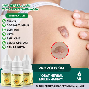 Obat Keloid Daging Tumbuh Daging Jadi Kutil Skin Tag Papiloma Bekas Luka Operasi Koreng Hitam - Propolis SM Herbal Alami