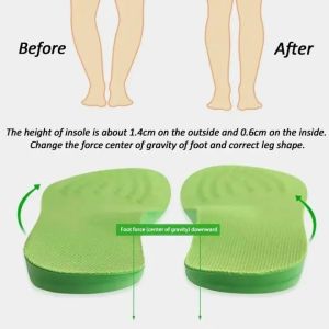 1Pair Orthopedic Arch Support Insoles O/X-Leg Orthotics Insole Valgus Varus Shoe Pads Massaging Pad for Shoes Inserts Sole Feet Care