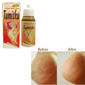 TUMITKU OBAT KAKI PECAH Original BPOM Solusi Kaki Pecah-pecah Dan Kapalan ukuran 30 ml