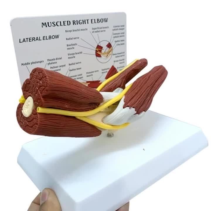 A functional model of nerve-ligaments in human muscles, elbows, joints ...