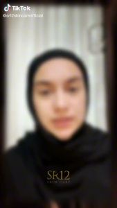 Masker Kopi SR12: Solusi Menghaluskan Wajah & Mengatasi Komedo