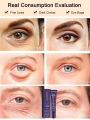 Eye cream that reduces fine lines and tightens skin around the eyes eye firming gel. 