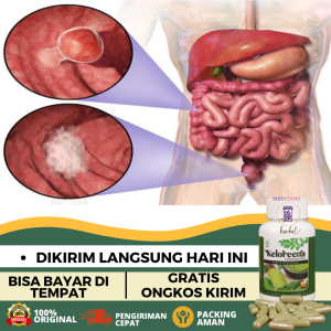 Obat Kanker Usus Obat Radang Usus Obat Radang Usus Besar Obat Infeksi Usus Obat Pembersih Usus Kotor Obat Herbal Penyakit Usus Obat Usus Luka Obat Penyumbatan Rongga Usus Obat Kram Usus Obat Peradangan Pada Usus Dengan Keloreena Kapsul 50 Kapsul