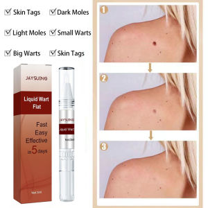 【Beli 2 gratis 1】Penghilang Kutil Dan Tahi Lalat Skin tag remover Obat kutil Penghilang Kutil Di Wajah Penghilang tahi lalat di wajah Obat kutil di leher Obat kutil di wajah Penghilang Kutil Di Wajah Salep kutil Penghilang tahi lalat Obat kutil di kelamin