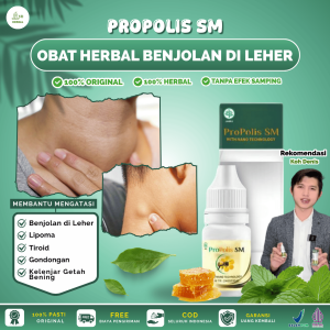 Propolis SM untuk Benjolan di Leher Kelenjar Getah Bening Lipoma Tiroid di Leher Gondongan BPOM dan Halal MUI