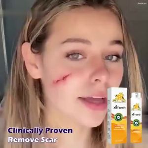 Ximonth Bee Venom Peptide Spray Reduces Stretch Marks and Postpartum Scars Smoothes Skin Body Care Spray