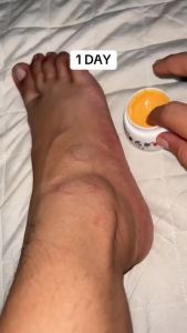 【Ship in 24H】Skin Cream Bai Yaolang 20g Ointment Cream Anti-bite Herbal Genuine Suitable for Children Adults Elderly Anti-itching Skin Mosquito Bites Antibacterial for Children Adults