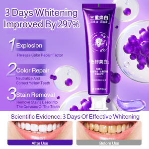 Lysozyme whitening toothpaste Perfume toothpaste Bacteria-killing and breath-freshening toothpaste Improve yellow teeth Stain-removing and whitening toothpaste