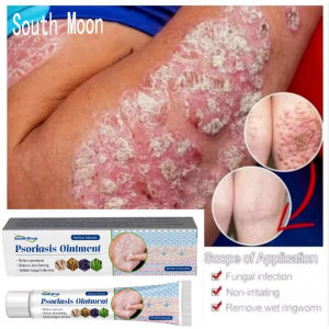 South Moon Gamot sa kati kati sa balat Psoriasis Eczema Ointment Treatment Cream Herbal Antibacterial Cream for Itchy Skin Allergy Antifungal Cream Anti Itch Cream for Skin