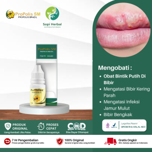 Obat Bintik Putih Di Bibir Obat Penghilang Bintik Bintik Putih di Bibir Obat Bibir Pecah dan Kering Obat Bibir Bintik Berair Bercak Putih di Sekitar Bibir Infeksi Jamur Pada Bibir Dengan Propolis Sm