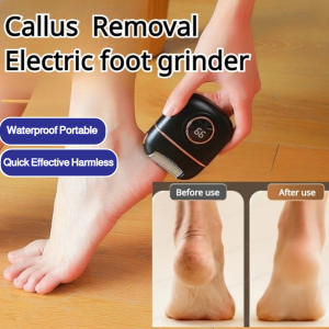 【Original Genuine】Automatic Digital Exfoliator Foot Dead Skin Remover 脚部美容磨脚器 Kecantikan Kaki Pembuang Kulit Mati Kaki Digital Exfoliator Automatik USB Rust-Proof and Moisture-Proof Washable Ceramic Foot Exfoliator