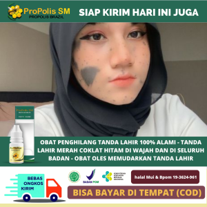 Obat Penghilang Tanda Lahir Tanda Lahir Coklat Hitam Merah Penghilang Tanda Lahir di Wajah Obat Pengempis Penghilang Daging Jadi Obat Penghilang Kutil Perontok Skin Tag Penghilang Bekas Jerawat - Propolis SM