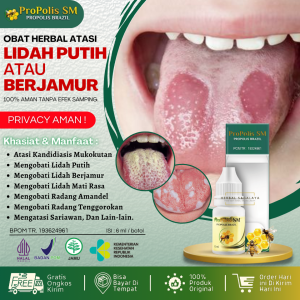 Obat Herbal Untuk Atasi Lidah Putih Lidah Berjamur Kandidiasis Mukokutan Lidah Perih Lidah Mati Rasa Lidah Kebas Radang Lidah - Propolis SM Alami 100% Original BPOM MUI