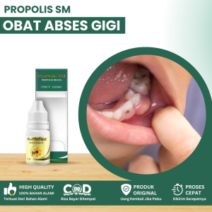 Obat Abses Gigi Obat Infeksi Akar Gigi Obat Benjolan Bernanah Obat Radang Gusi Obat Abses Gigi Nyeri Benjolan Di Gusi Untuk Anak Dan Dewasa Dengan Propolis SM