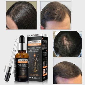 【BUY 1 TAKE 1】Ginger shampoo hair grower hair growth horse shampoo ng kabayo ketoconazole shampoo