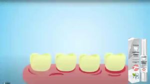 【New Arrival】"Renewal Magic Wand" for Teeth! OUHOE Teeth Whitening Pen Light Up a Charming Smile
