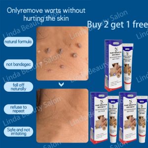 Skin tag remover cream Warts removal cream Corn Removal 20g Antibacterial Foot Warts Hand Warts Corn Skin Tag Warts Remover
