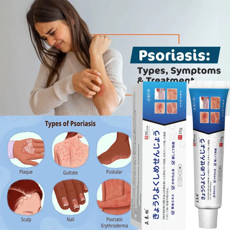Japan Psoriasis Cream treats itchy skin, psoriasis, ECZEMA ...