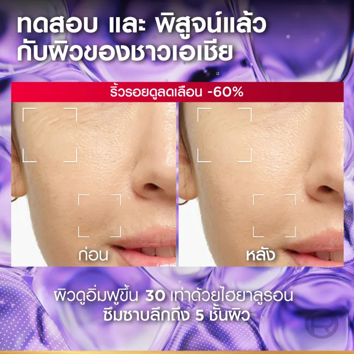 %5B%E0%B9%81%E0%B8%9E%E0%B9%87%E0%B8%81%E0%B8%84%E0%B8%B9%E0%B9%88%5D%20%E0%B8%A5%E0%B8%AD%E0%B8%A3%E0%B8%B5%E0%B8%AD%E0%B8%B1%E0%B8%A5%20%E0%B8%9B%E0%B8%B2%E0%B8%A3%E0%B8%B5%E0%B8%AA%20L'Or%C3%A9al%20Paris%20Revitalift%20Hyaluronic%20Acid%20Replumping%20Serum%2030ml%20%E0%B9%80%E0%B8%8B%E0%B8%A3%E0%B8%B1%E0%B9%88%E0%B8%A1%E0%B9%84%E0%B8%AE%E0%B8%A2%E0%B8%B2%E0%B9%80%E0%B8%95%E0%B8%B4%E0%B8%A1%E0%B8%84%E0%B8%A7%E0%B8%B2%E0%B8%A1%E0%B8%8A%E0%B8%B8%E0%B9%88%E0%B8%A1%E0%B8%8A%E0%B8%B7%E0%B9%89%E0%B8%99%20-%20Image%205