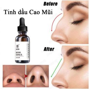 Tinh Dầu Nâng Mũi Tạo Hình Tự Nhiên – Nâng Sống Mũi Thẳng Đẹp Hiệu Quả Tại Nhà