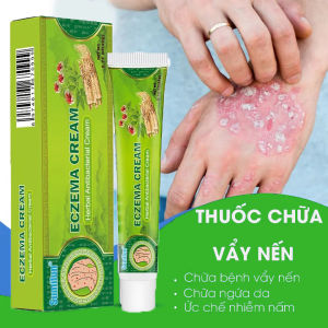 Sumifun Kem Bôi Nấm Ngứa Hắc Lào Vảy Nến Á Sừng Viêm Da Dị Ứng Nứt Gót Chân Lang Ben. Kem Bôi Da Liễu Ngoài Da