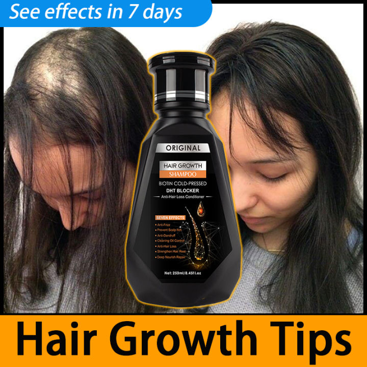 Original Anti Hair Loss Ginger Hair Shampoo 250ml Oil Control Anti Original Anti Hair Loss Ginger Hair Shampoo 250ml Oil Control Anti