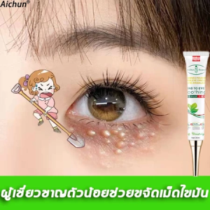 Aichun ครีมลดถุงใต้ตา 30ml ปรับปรุงอนุภาคไขมันลดถุงใต้ตา อายครีม ครีมไต้ตา ดูแลรอบดวงตา ครีมทาใต้ตาดำ ครีมบำรุงรอบดวงตา อายเจล ครีมใต้ตา ครีมบำรุงขอบตา ครีมทาถุงใต้ตา ครีมทาตาดำ ครีมแก้ขอบตาดำ ครีมทารอบดวงตา ครีมบำรุงใต้ตา