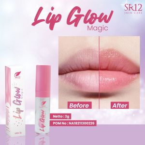 lip balm pemerah bibir lip care natural dan cherry SR12 pelembab bibir kering dan pecah pecah aman BPOM halal MUI