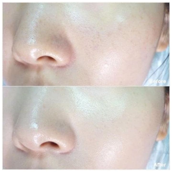 Kem%20n%C3%A1m%20Dr%20Melaxin%20,kem%20n%C3%A1m%20TX,%20d%C6%B0%E1%BB%A1ng%20tr%E1%BA%AFng%20da,%20m%E1%BB%9D%20n%C3%A1m%20t%C3%A0n%20nhang,%20gi%E1%BA%A3m%20th%C3%A2m%2050ml%20-%20Image%208