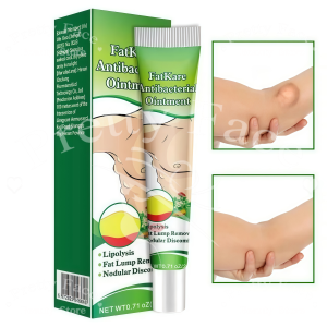 20g Lipoma Removal Cream safe and effective can repair lipomas on the ears and hands gently soothing and repairing.
