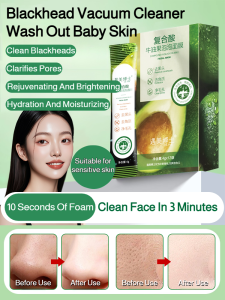 【Wash Out Baby Skin】Complex Acid Avocado Bubble Mask Beauty Mask Hydrating Mask Exfoliating Mask Moisturizing And Rejuvenating Mask Pore Cleansing Mask Revitalize Skin Brighten Skin Tone