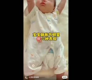 Baby Bloating Patch Anti Colic Stomach Patch 婴儿小儿胀气贴肚脐贴 肠绞痛神器